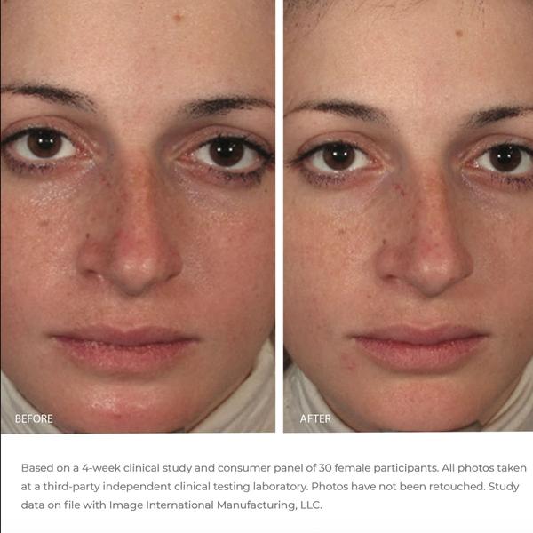 Balancing Gel Masque | ORMEDIC | The Beauty Room | Kelowna Skin Laser Aesthetics
